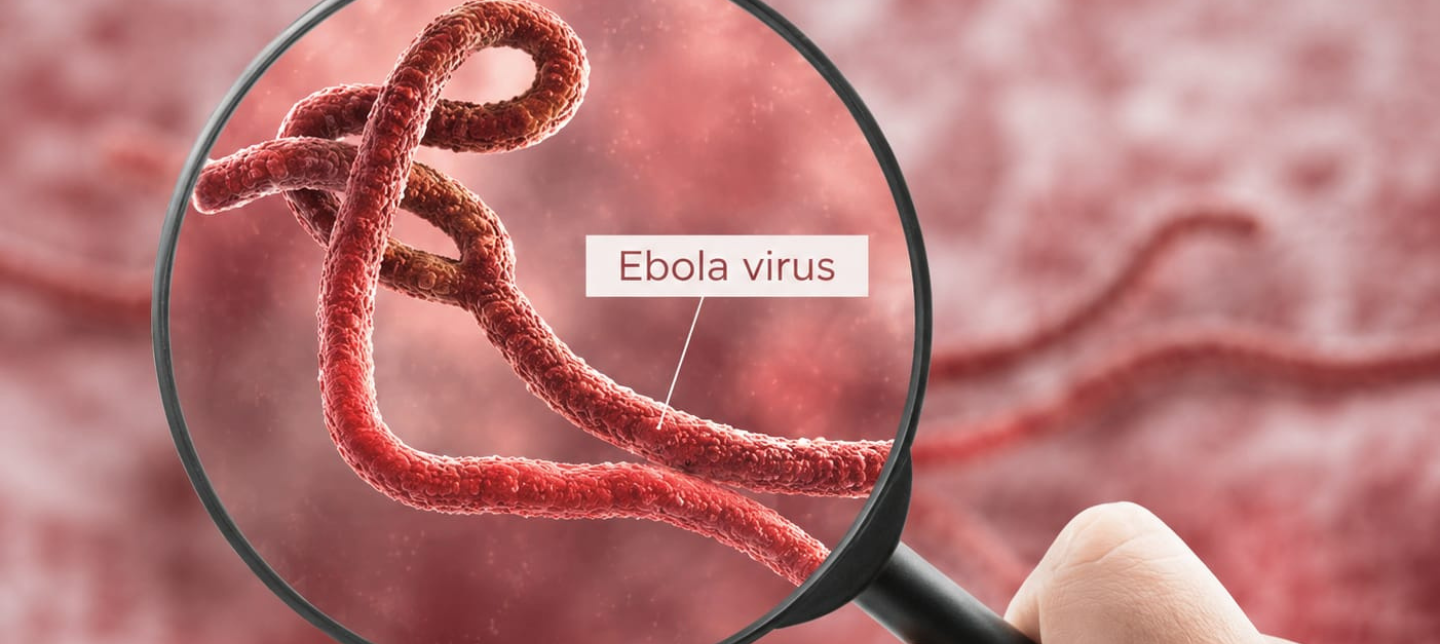 Ebola Slider